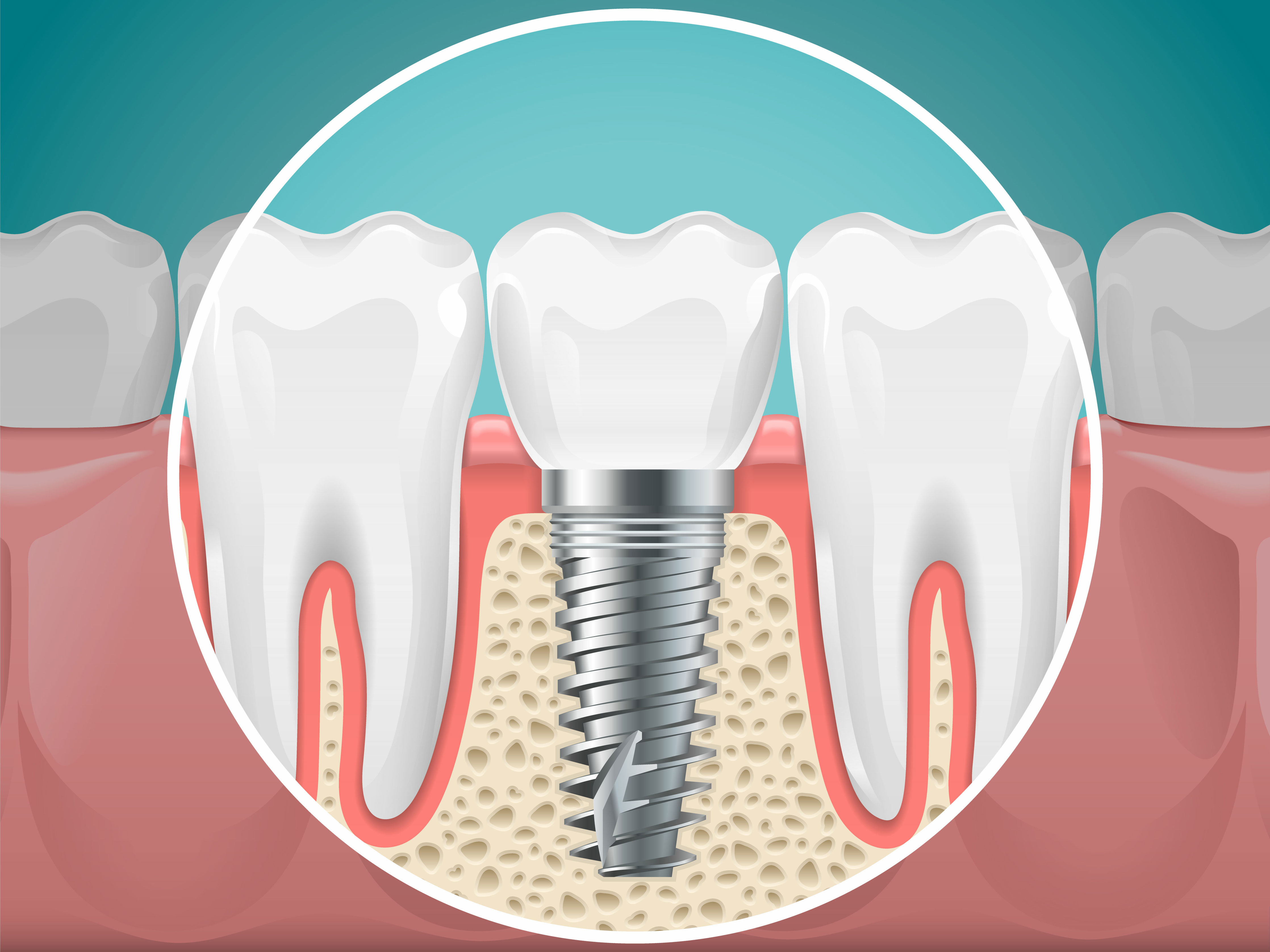 Brookfield Smiles Inc. | Root Canals, Preventative Program and Periodontal Treatment